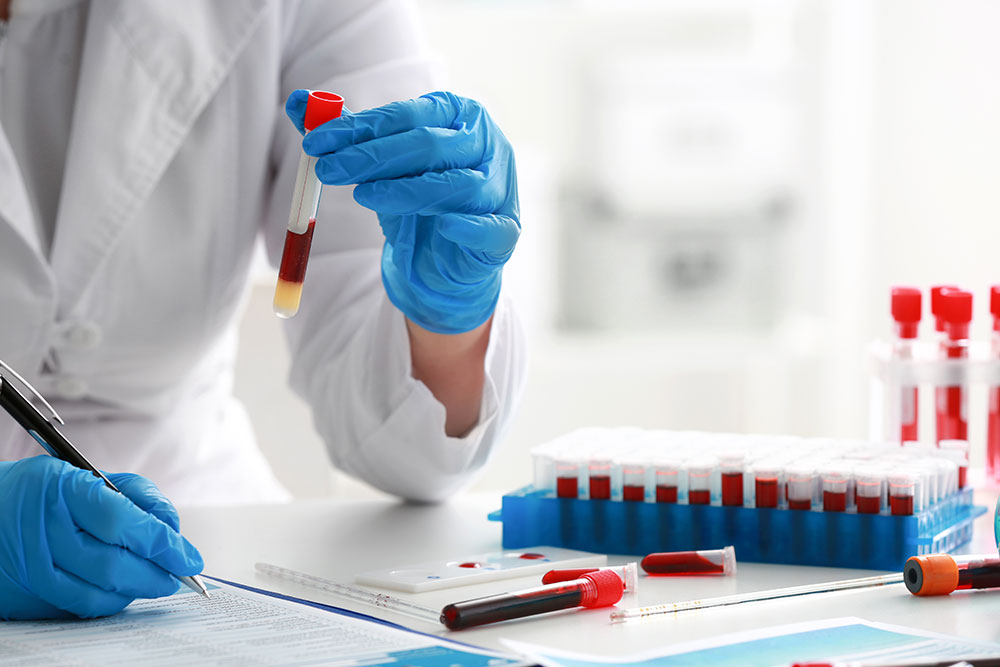 Veterinary professional analyzing a blood sample in a laboratory to evaluate a pet's health and assist with medical diagnosis.